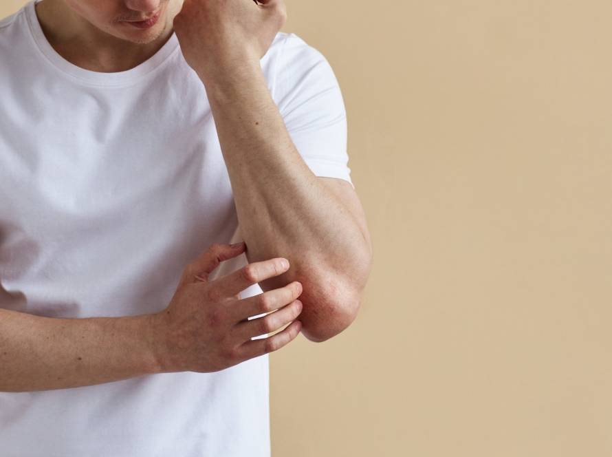 does psoriasis decrease life expectancy