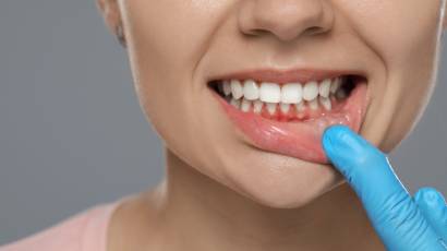 can gum disease cause other health issues