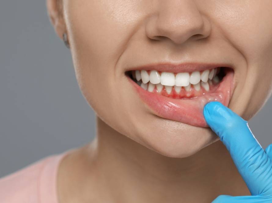 can gum disease cause other health issues
