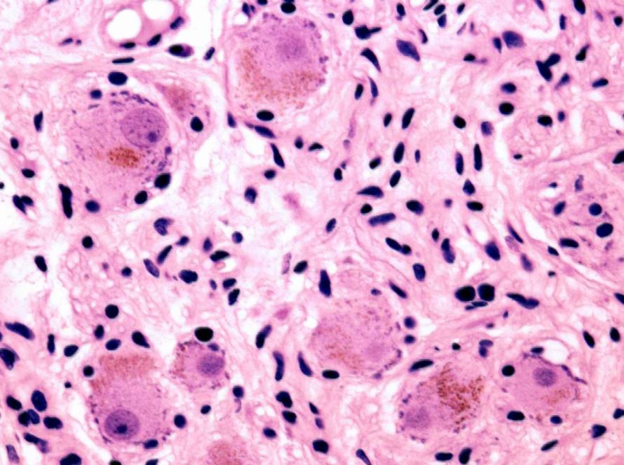 lipofuscin and aging