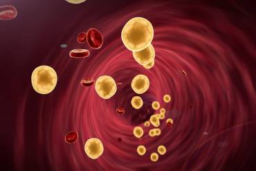 Does LDL increase with age? Link between aging and cholesterol