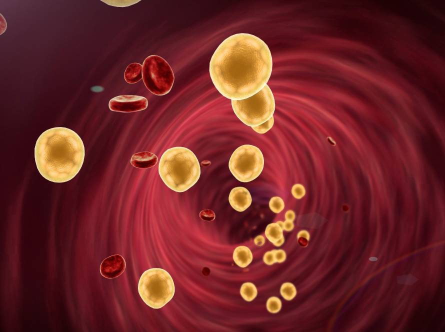 does ldl increase with age