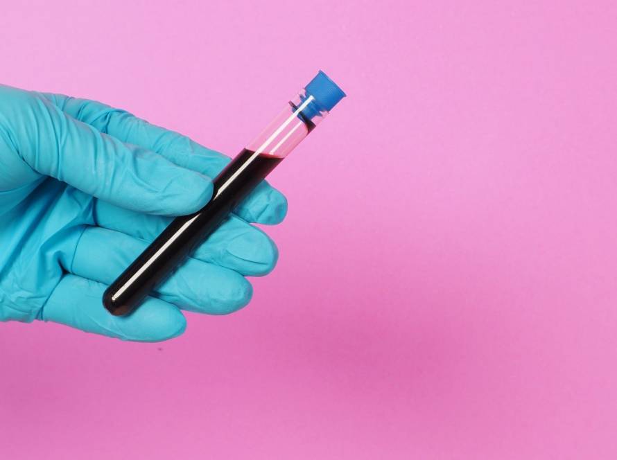how triglycerides affect the body